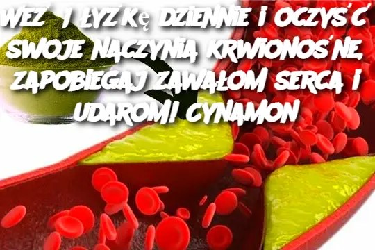 Weź 1 łyżkę dziennie i oczyść swoje naczynia krwionośne, zapobiegaj zawałom serca i udarom! Cynamon